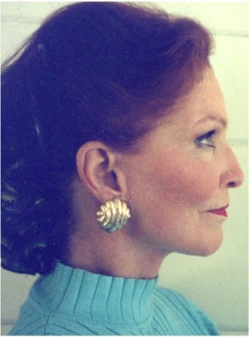 After Image: Facelift - right-side