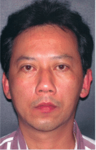 After Image: Male Facial Procedures
