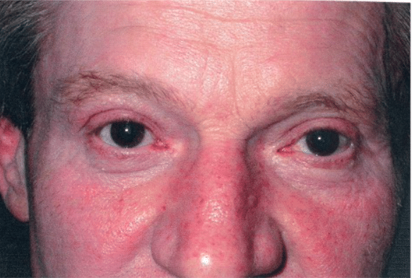 After Image: Male Facial Procedures - front