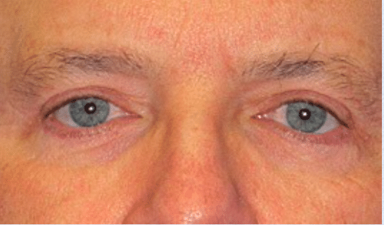 After Image: Male Facial Procedures - front